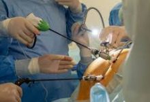 Photo of 50 جراحة لأطباء مستشفى ايسطو