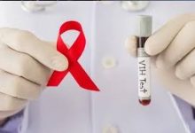 Photo of حملة للكشف عن داء السيدا