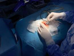 Photo of أطباء يعيدون الأمل لأطفال مرضى