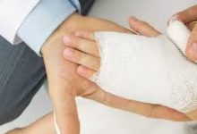 Photo of إدراج مصالح متخصصة في علاج الحروق